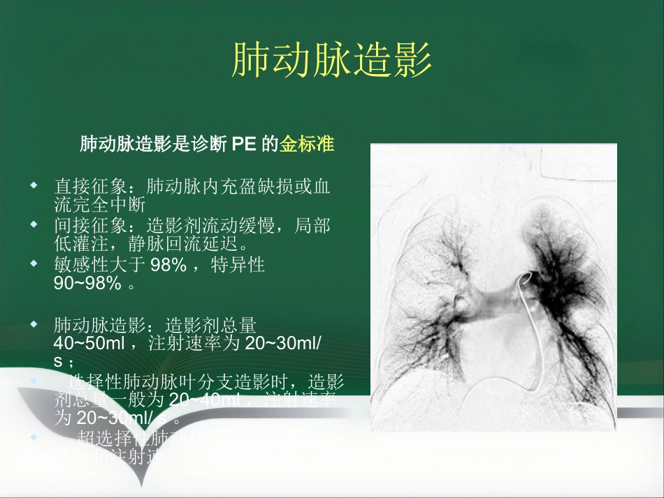 肺栓塞 介入治疗讲解_第7页