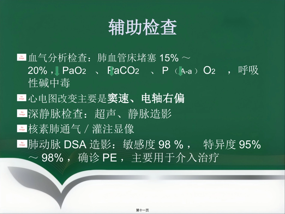 肺栓塞介入治疗(1)_第11页