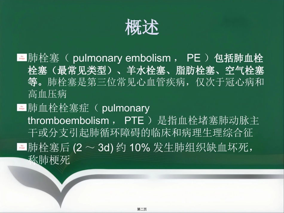 肺栓塞介入治疗(1)_第2页