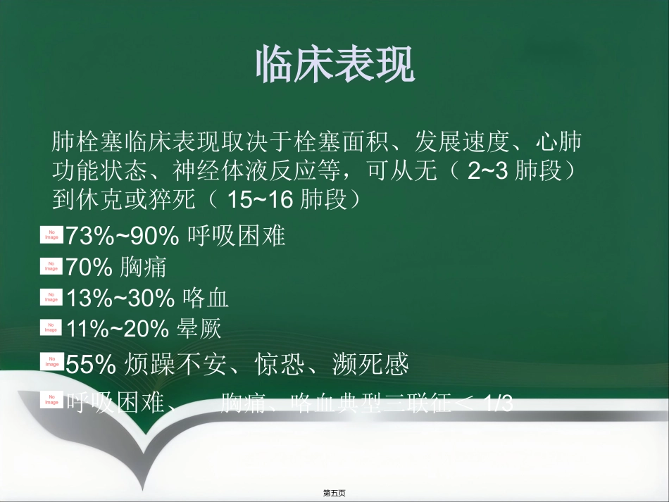 肺栓塞介入治疗(1)_第5页
