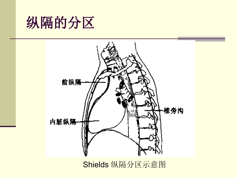 154肿瘤科-纵隔肿瘤_第13页