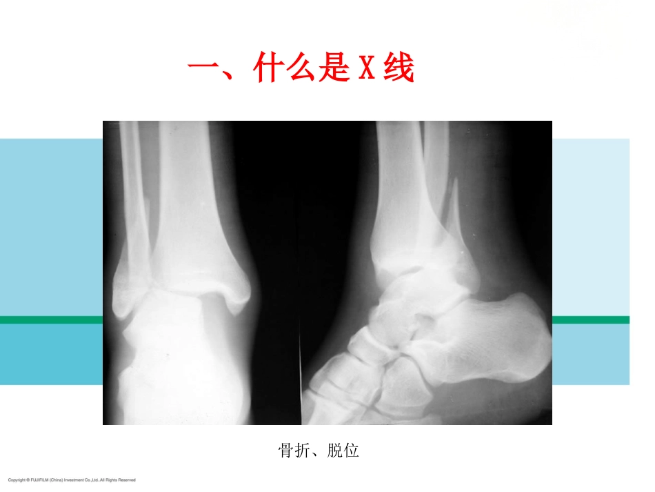 X线放射影像基础_第6页