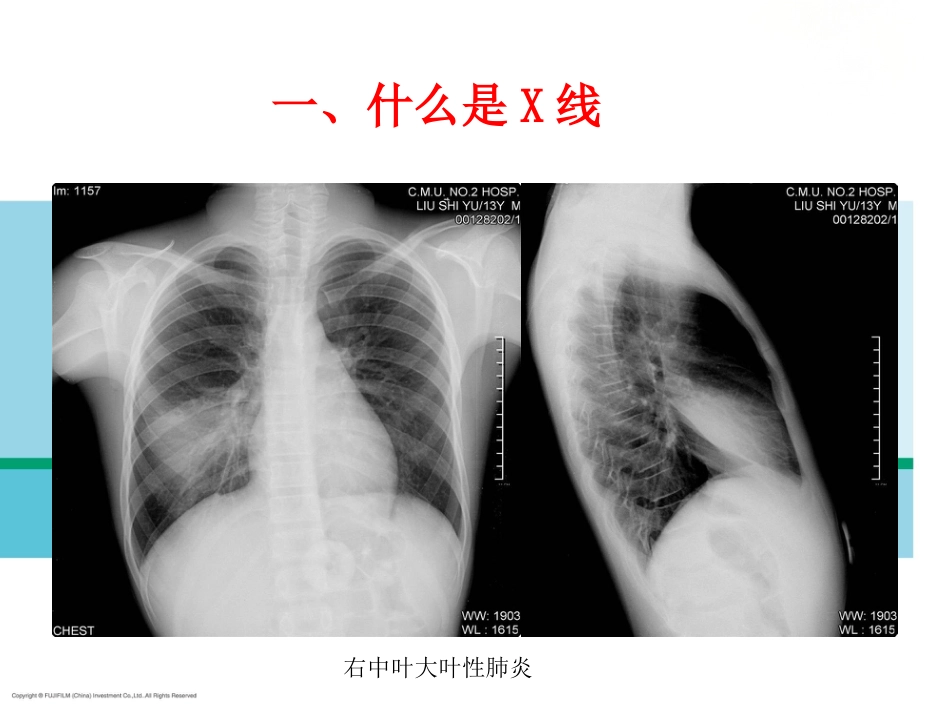 X线放射影像基础_第7页