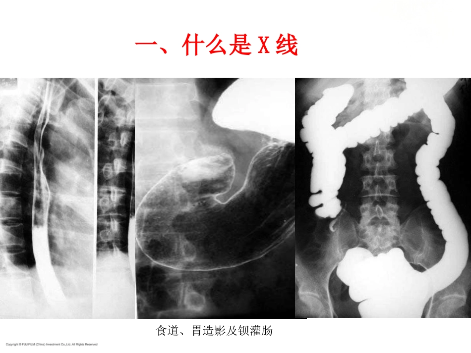 X线放射影像基础_第8页
