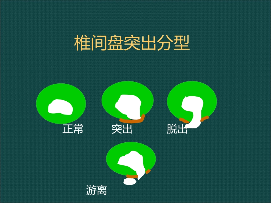 常见脊柱骨骼系统病变影像诊断_第8页