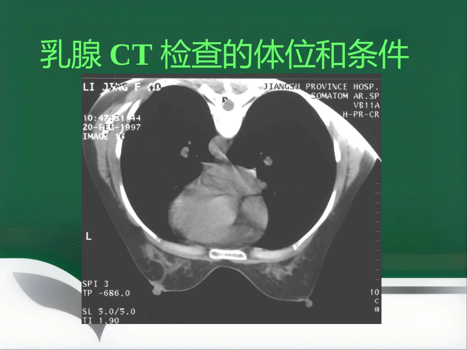 d乳腺疾病的影像诊断_第8页