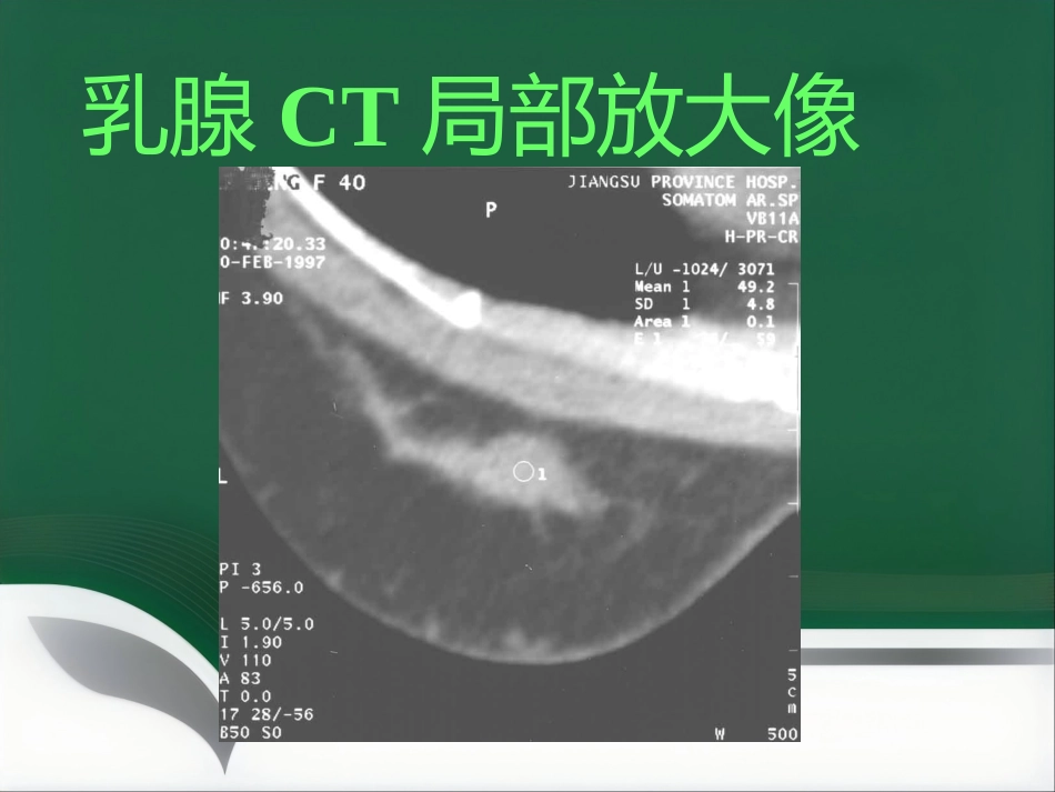 d乳腺疾病的影像诊断_第9页