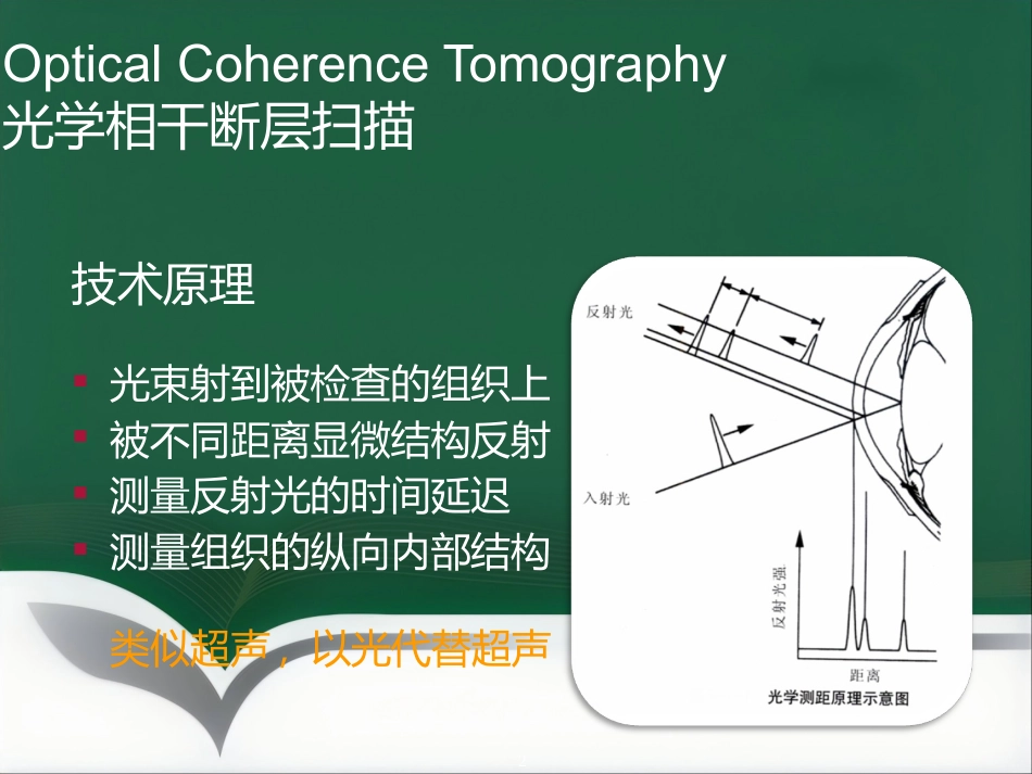 OCT影像技术的临床应用_第2页
