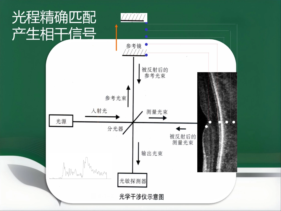 OCT影像技术的临床应用_第4页