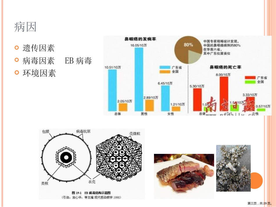 鼻咽癌影像诊断PPT_第3页