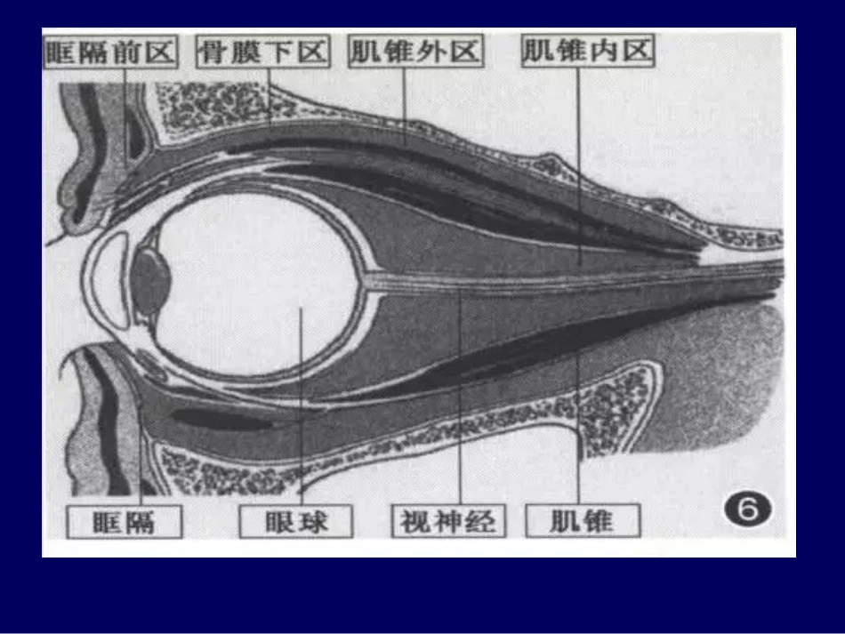 常见眼眶内肿瘤的影像诊断分析 ppt课件_第3页