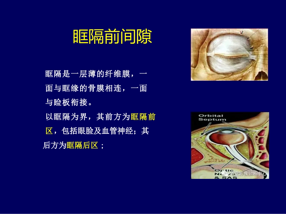 常见眼眶内肿瘤的影像诊断分析 ppt课件_第4页