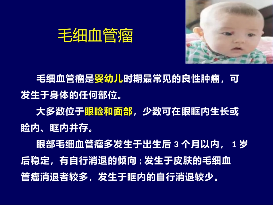 常见眼眶内肿瘤的影像诊断分析 ppt课件_第6页