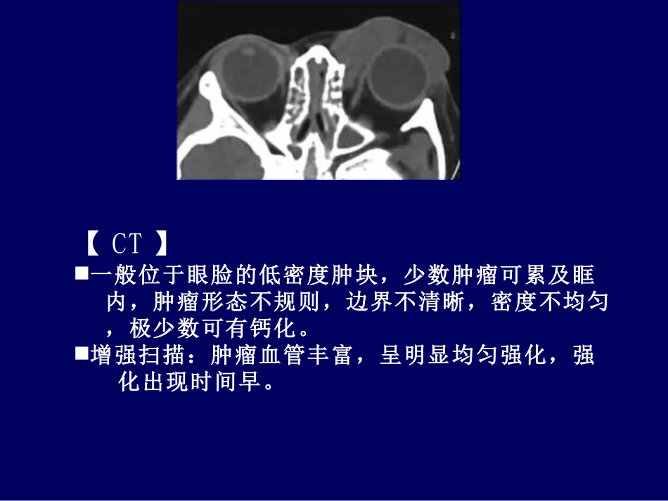 常见眼眶内肿瘤的影像诊断分析 ppt课件_第8页