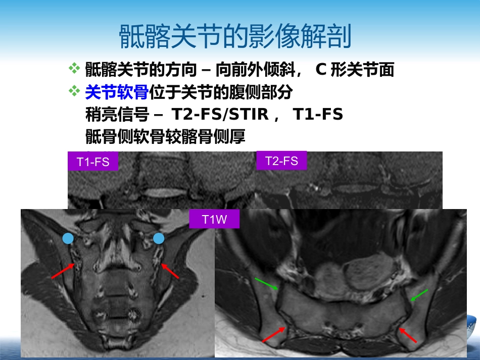 SpA骶髂关节炎的影像学诊断和鉴别诊断课件_第10页