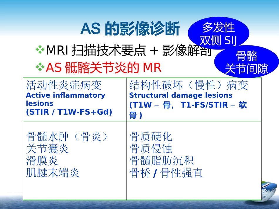 SpA骶髂关节炎的影像学诊断和鉴别诊断课件_第12页