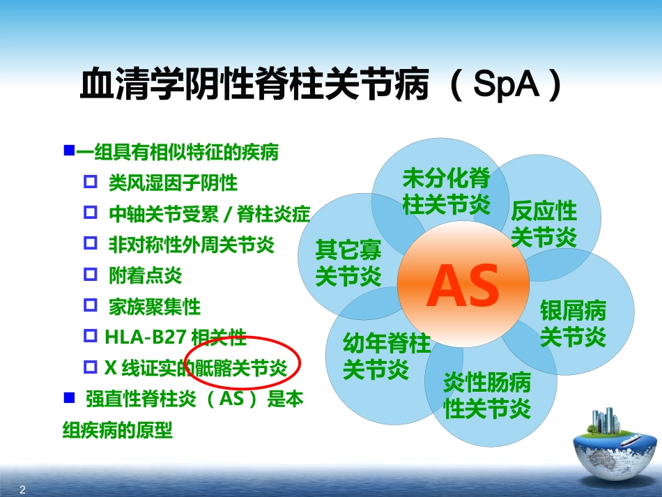 SpA骶髂关节炎的影像学诊断和鉴别诊断课件_第2页