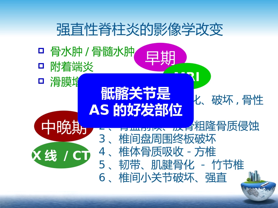SpA骶髂关节炎的影像学诊断和鉴别诊断课件_第3页