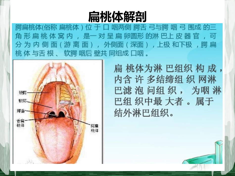 扁桃体淋巴瘤影像诊断_第5页