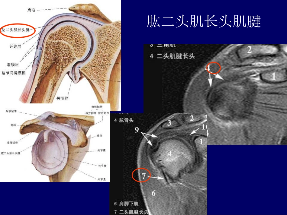 外影像与诊断学：：肩关节应用解剖及腱鞘肌腱病的磁共振影像诊断_第10页
