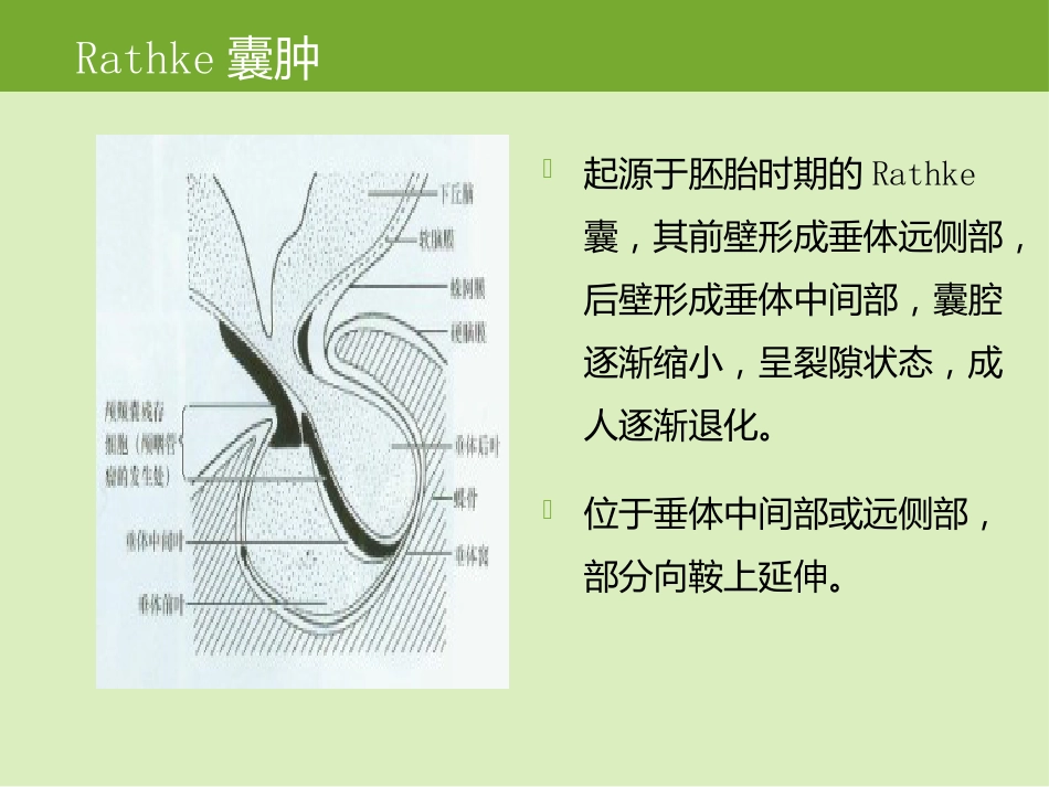 鞍区肿瘤的影像诊断与鉴别诊断_第13页