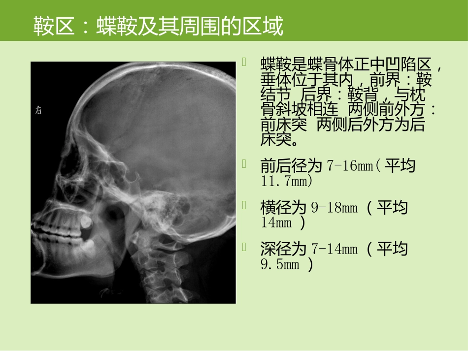 鞍区肿瘤的影像诊断与鉴别诊断_第2页