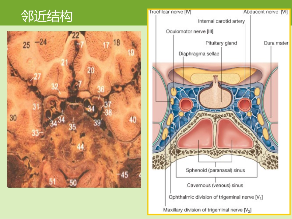 鞍区肿瘤的影像诊断与鉴别诊断_第4页