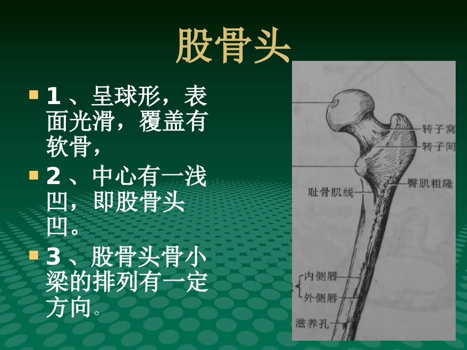编辑股骨头缺血坏死影像学诊断_第4页