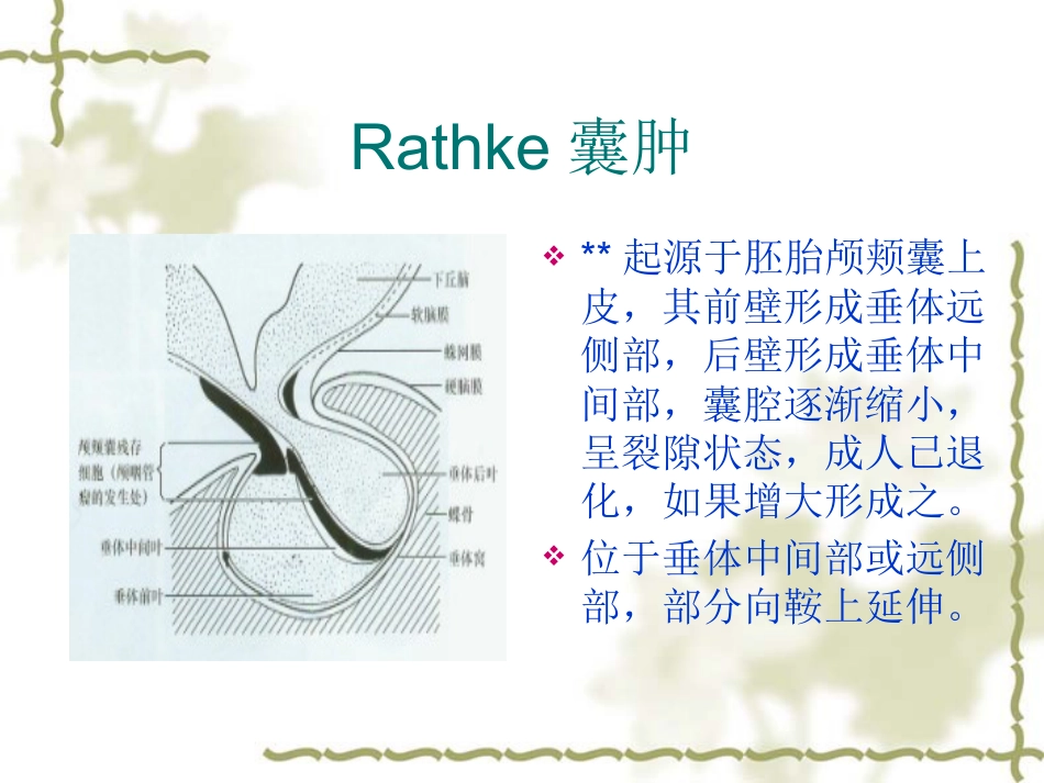 鞍区肿瘤影像表现PPT_第15页