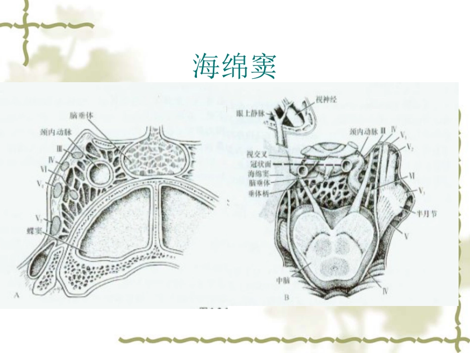 鞍区肿瘤影像表现PPT_第3页