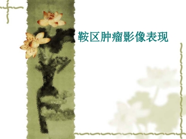 鞍区肿瘤影像表现PPT