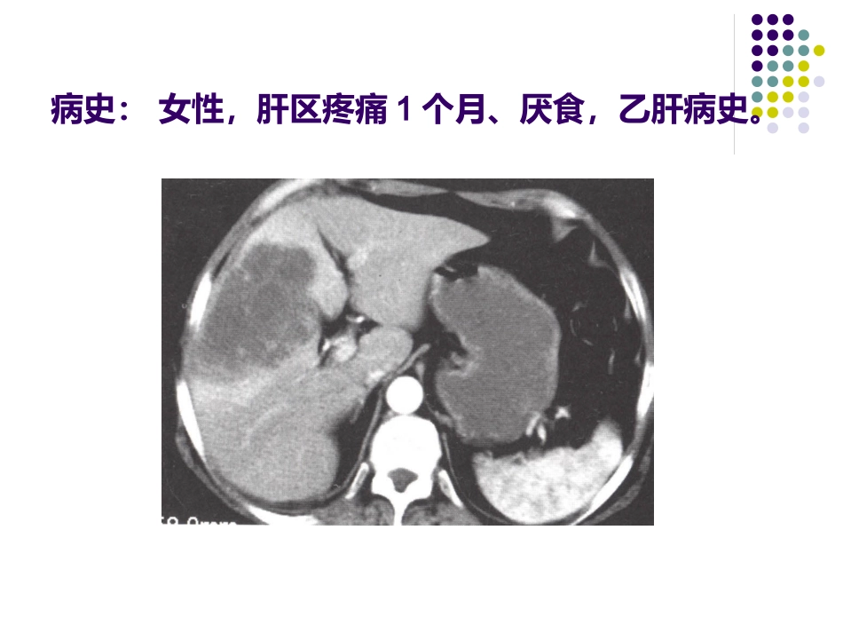 《CT影像的识》_第11页