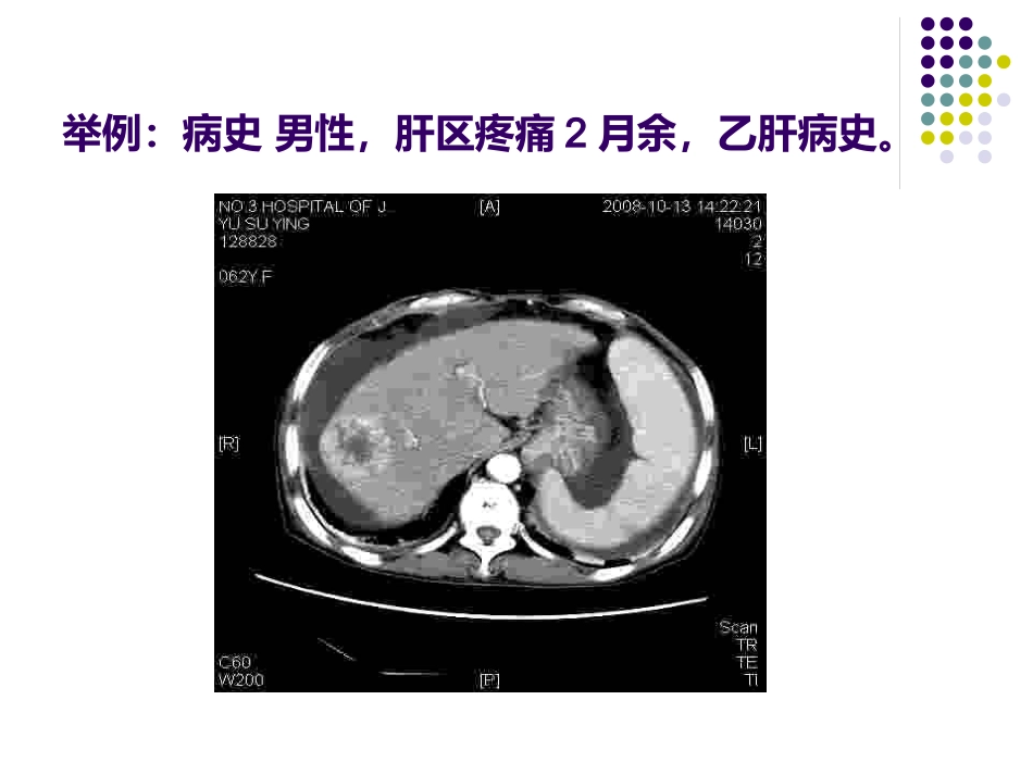 《CT影像的识》_第12页