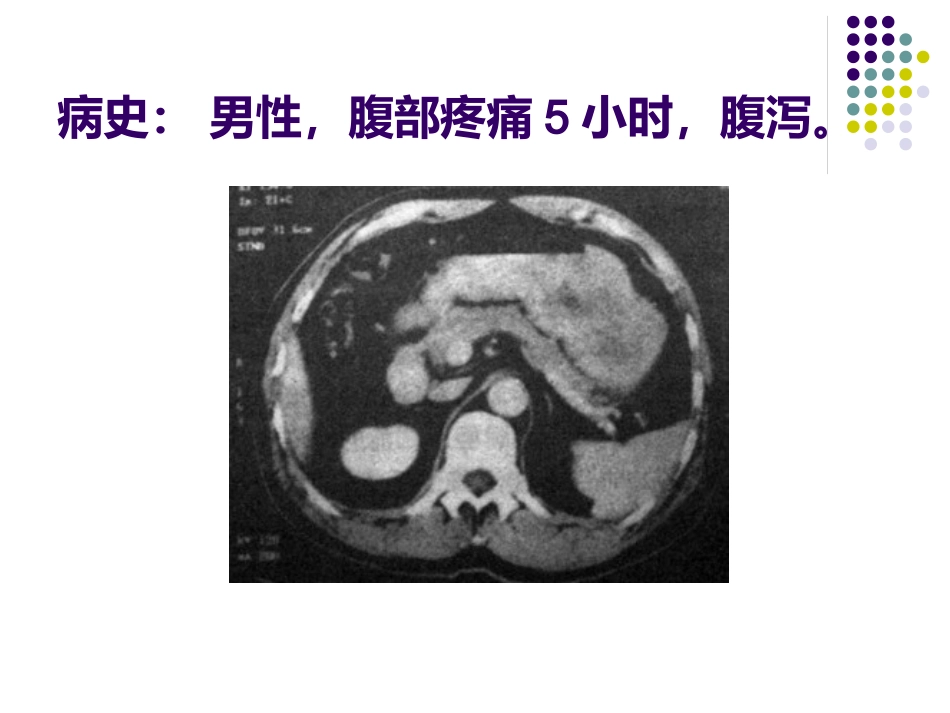 《CT影像的识》_第14页