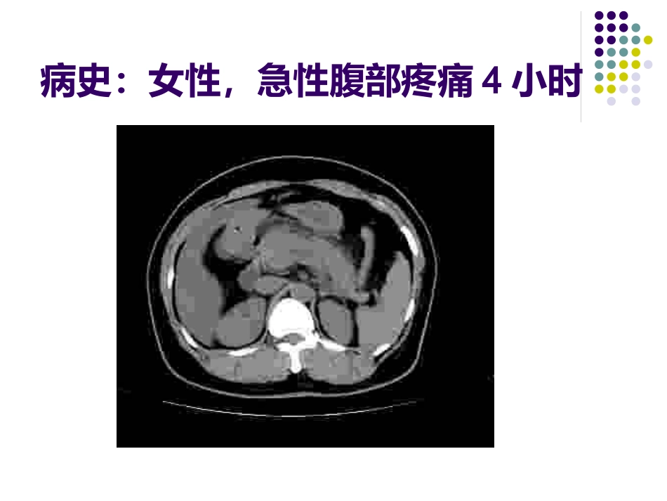 《CT影像的识》_第15页