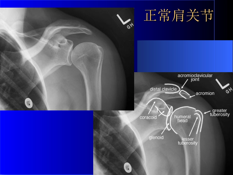 外影像与诊断学：骨科常见疾病的X线表现_第2页