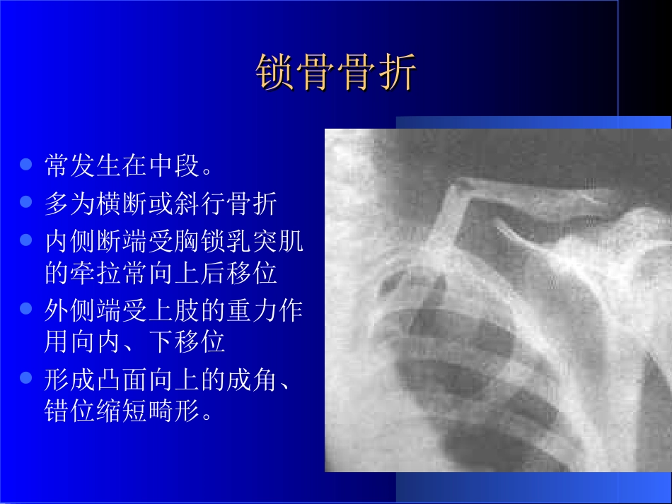 外影像与诊断学：骨科常见疾病的X线表现_第3页