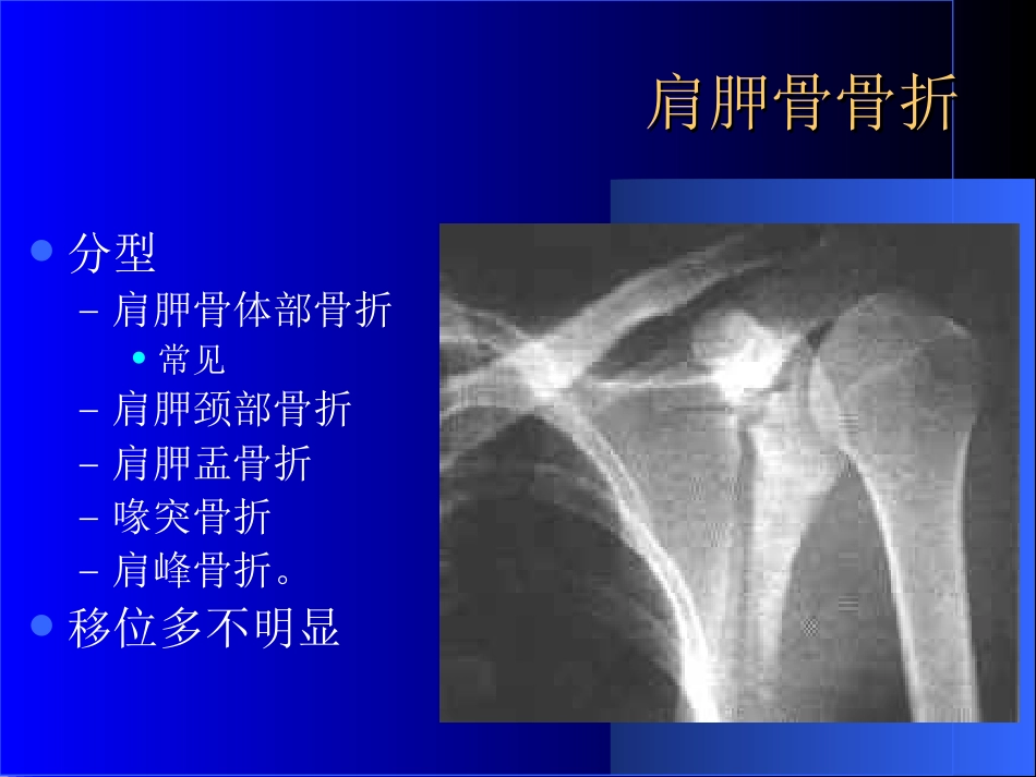 外影像与诊断学：骨科常见疾病的X线表现_第4页