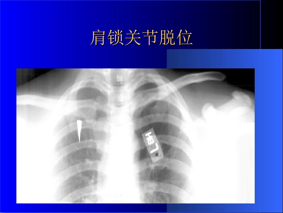 外影像与诊断学：骨科常见疾病的X线表现_第5页