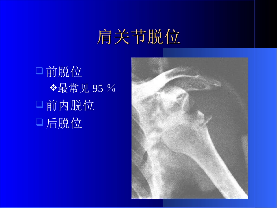 外影像与诊断学：骨科常见疾病的X线表现_第6页