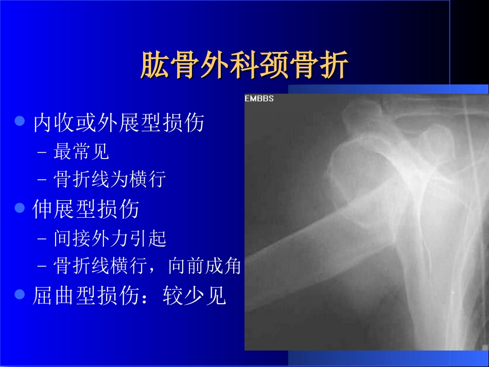 外影像与诊断学：骨科常见疾病的X线表现_第7页