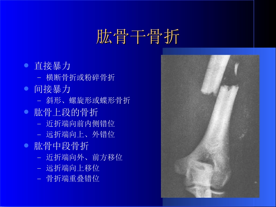 外影像与诊断学：骨科常见疾病的X线表现_第8页