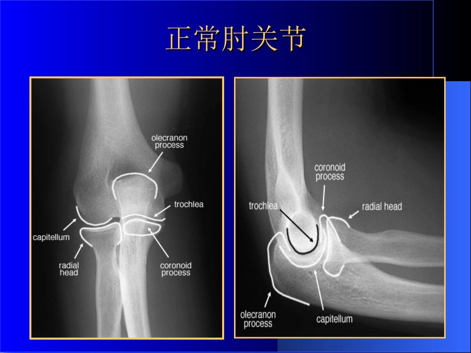 外影像与诊断学：骨科常见疾病的X线表现_第9页