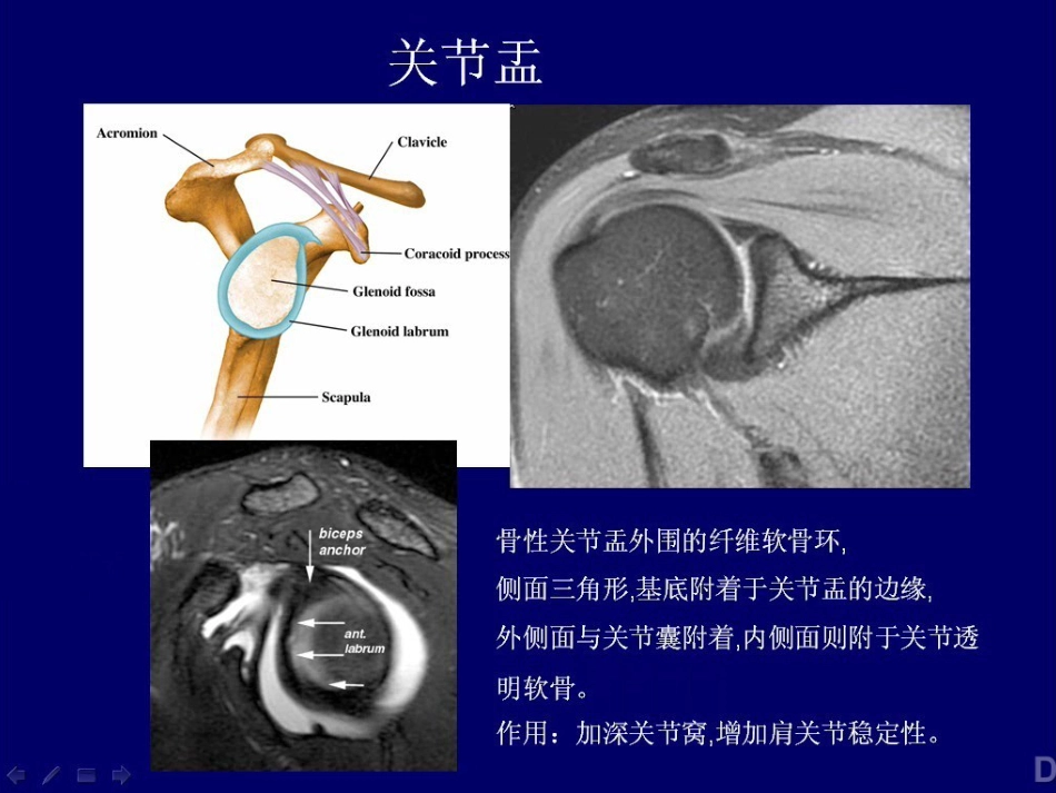外影像与诊断学：肩关节MR_第5页
