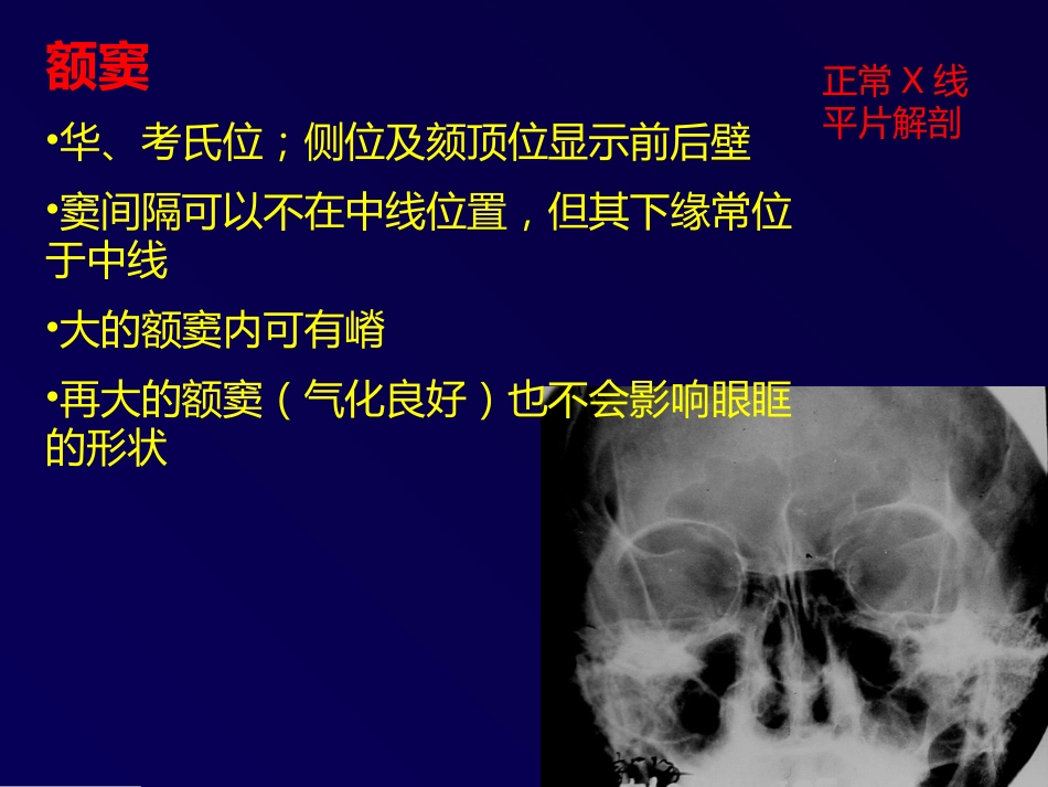 鼻和副鼻窦肿瘤影像诊断PPT幻灯片课件_第5页