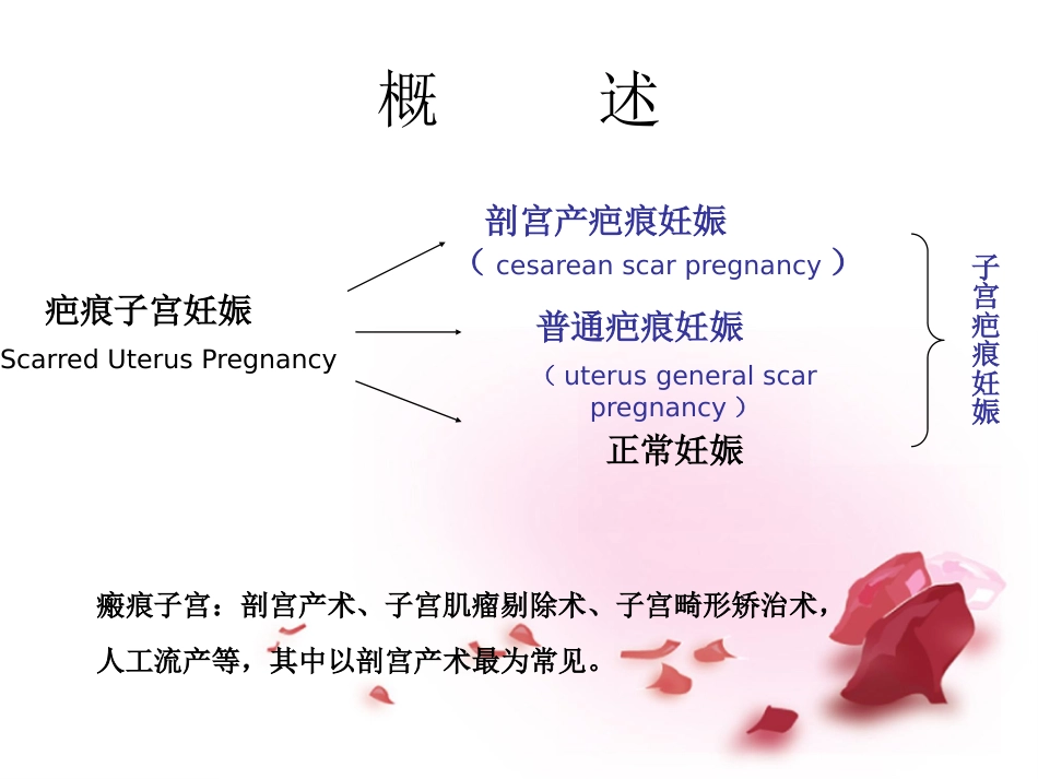 疤痕妊娠的影像学诊断PPT课件_第2页