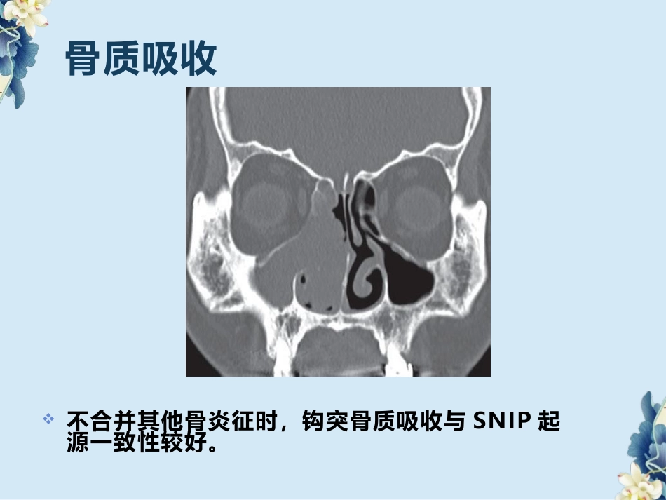 鼻腔鼻窦内翻性RU头状瘤(SNIP)的影像诊断与鉴别诊断_第9页