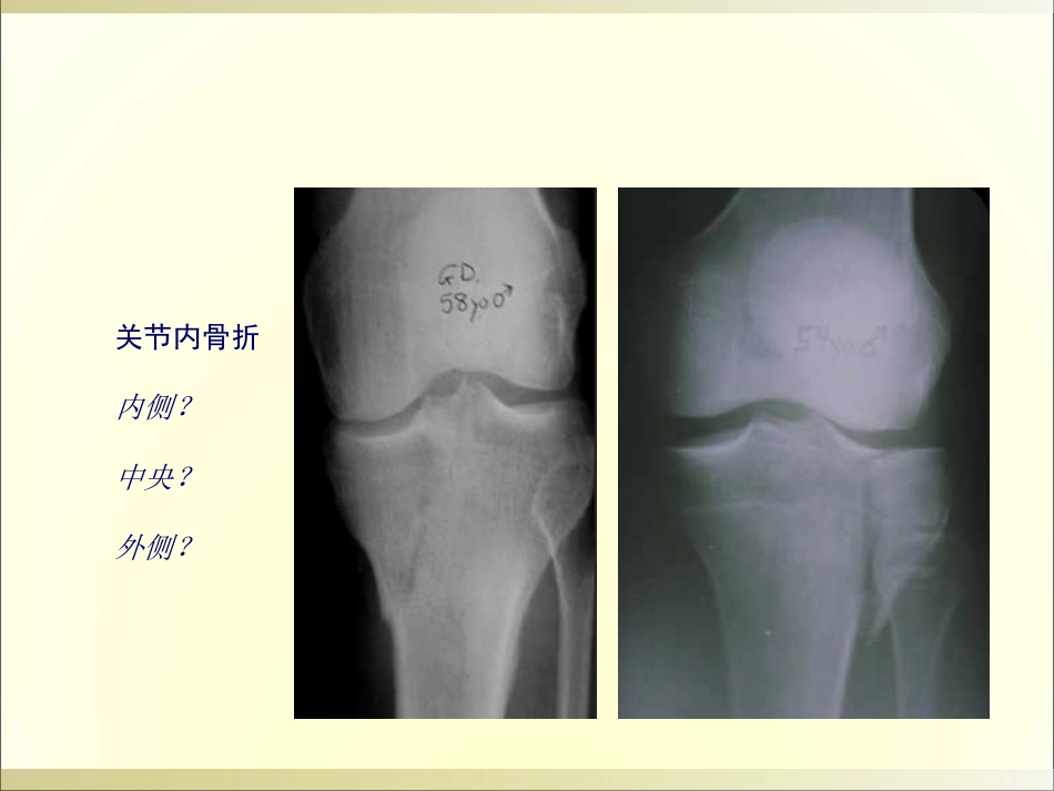 外影像与诊断学：骨科读片基础_第10页