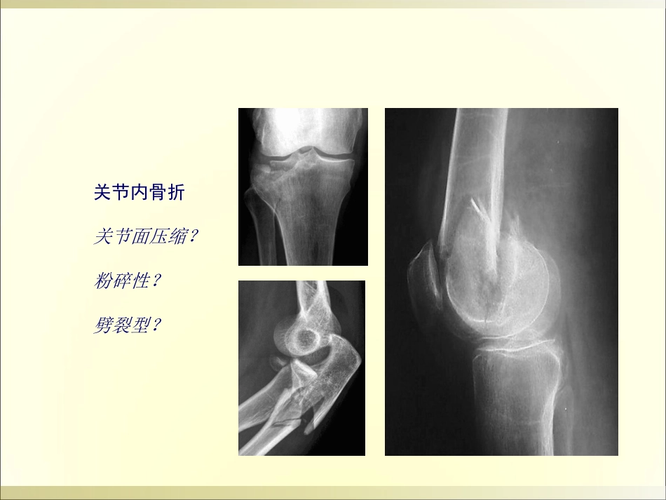 外影像与诊断学：骨科读片基础_第11页