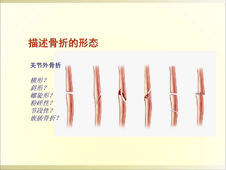 外影像与诊断学：骨科读片基础_第12页